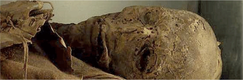 Guanche-Mumie auf Teneriffa, Detail des erhaltenen Gesichts.